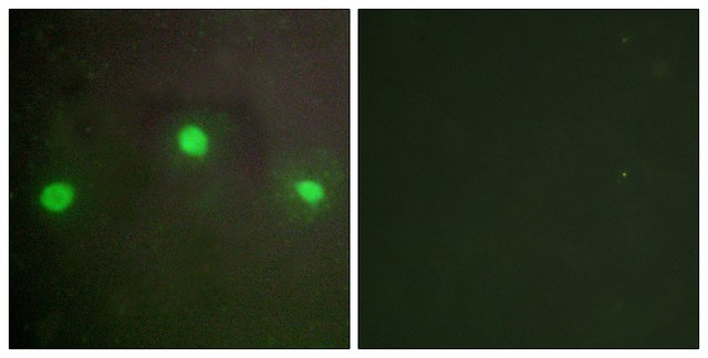 Anti-ATRX antibody produced in rabbit affinity isolated antibody