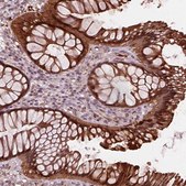 Anti-SRI antibody produced in rabbit Prestige Antibodies&#174; Powered by Atlas Antibodies, affinity isolated antibody