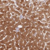 Anti-GYG2 antibody produced in rabbit Prestige Antibodies&#174; Powered by Atlas Antibodies, affinity isolated antibody, buffered aqueous glycerol solution
