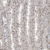 Anti-KPNB1 antibody produced in rabbit Prestige Antibodies&#174; Powered by Atlas Antibodies, affinity isolated antibody, buffered aqueous glycerol solution