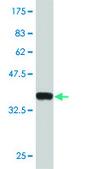 Monoclonal Anti-MECP2 antibody produced in mouse clone 1B11, purified immunoglobulin, buffered aqueous solution