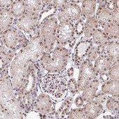 Anti-SIN3A antibody produced in rabbit Prestige Antibodies&#174; Powered by Atlas Antibodies, affinity isolated antibody, buffered aqueous glycerol solution