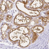 Anti-CSN1S1 antibody produced in rabbit Prestige Antibodies&#174; Powered by Atlas Antibodies, affinity isolated antibody