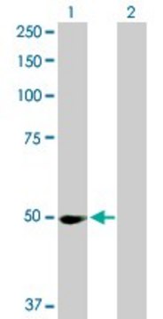 Anti-PPM1F antibody produced in rabbit purified immunoglobulin, buffered aqueous solution
