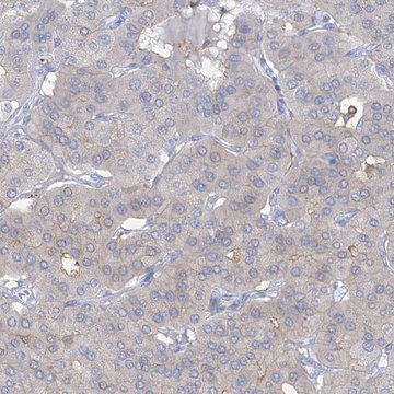 Anti-TRMT2B antibody produced in rabbit Prestige Antibodies&#174; Powered by Atlas Antibodies, affinity isolated antibody, buffered aqueous glycerol solution