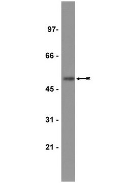 Anti-Histidine Tagged Antibody, clone 4D11, biotin conjugate clone 4D11, Upstate&#174;, from mouse