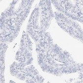 Anti-KRT15 antibody produced in rabbit Prestige Antibodies&#174; Powered by Atlas Antibodies, affinity isolated antibody, buffered aqueous glycerol solution