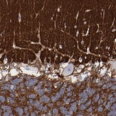 Anti-CADM3 antibody produced in rabbit Ab1, Prestige Antibodies&#174; Powered by Atlas Antibodies, affinity isolated antibody, buffered aqueous glycerol solution