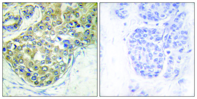 Anti-phospho-ACK1 (pTyr284) antibody produced in rabbit affinity isolated antibody