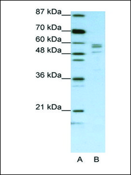 Anti-SARS (AB1) antibody produced in rabbit IgG fraction of antiserum