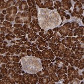 Anti-MTHFD1 antibody produced in rabbit Prestige Antibodies&#174; Powered by Atlas Antibodies, affinity isolated antibody, buffered aqueous glycerol solution