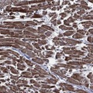 Anti-HTD2 antibody produced in rabbit Prestige Antibodies&#174; Powered by Atlas Antibodies, affinity isolated antibody, buffered aqueous glycerol solution