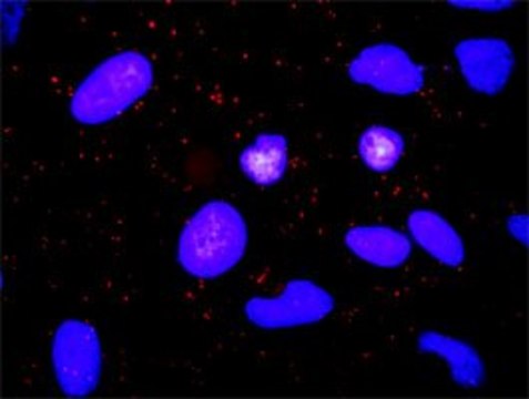 Anti-TGFA antibody produced in rabbit purified immunoglobulin, buffered aqueous solution