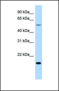 Anti-TEAD2 antibody produced in rabbit affinity isolated antibody