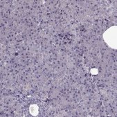 Anti-ACOT11 antibody produced in rabbit Prestige Antibodies&#174; Powered by Atlas Antibodies, affinity isolated antibody