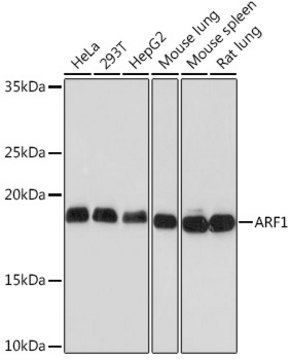 Anti-ARF1 Antibody, clone 0C5B3, Rabbit Monoclonal