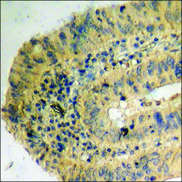 Anti-phospho-KIF20A (pSer528) antibody produced in rabbit affinity isolated antibody