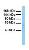Anti-MAP4K4, (N-terminal) antibody produced in rabbit affinity isolated antibody
