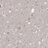Anti-WDR44 antibody produced in rabbit Prestige Antibodies&#174; Powered by Atlas Antibodies, affinity isolated antibody, buffered aqueous glycerol solution