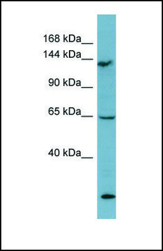 Anti-LATS1 antibody produced in rabbit affinity isolated antibody