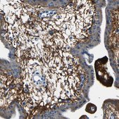 Anti-FBN2 antibody produced in rabbit Prestige Antibodies&#174; Powered by Atlas Antibodies, affinity isolated antibody, buffered aqueous glycerol solution