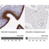 Anti-GOLGA5 antibody produced in rabbit affinity isolated antibody, buffered aqueous glycerol solution