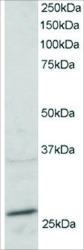 Anti-RAB11A/YL8 antibody produced in goat affinity isolated antibody, buffered aqueous solution