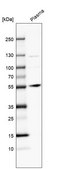 Anti-ANGPT1 antibody produced in rabbit Prestige Antibodies&#174; Powered by Atlas Antibodies, affinity isolated antibody, buffered aqueous glycerol solution, Ab2