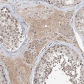 Anti-CARMIL3 antibody produced in rabbit Prestige Antibodies&#174; Powered by Atlas Antibodies, affinity isolated antibody, buffered aqueous glycerol solution