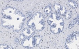 Anti-phospho-TSC2-Ser939 Antibody, clone 1G19 ZooMAb&#174; Rabbit Monoclonal recombinant, expressed in HEK 293 cells