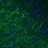 Monoclonal Anti-NEFM antibody produced in mouse Prestige Antibodies&#174; Powered by Atlas Antibodies, clone CL2705, purified immunoglobulin, buffered aqueous glycerol solution
