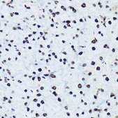 Anti-Phospho-RB(pSer780) Antibody, clone 8R5F5, Rabbit Monoclonal