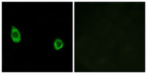 Anti-CHST9, C-Terminal antibody produced in rabbit affinity isolated antibody