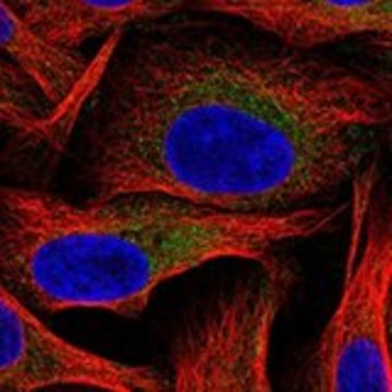 Anti-HK2 antibody produced in rabbit Prestige Antibodies&#174; Powered by Atlas Antibodies, affinity isolated antibody, buffered aqueous glycerol solution