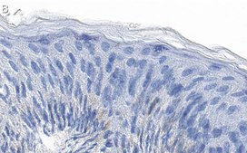 Anti-GRHL2 Antibody, clone 2N18 ZooMAb&#174; Rabbit Monoclonal recombinant, expressed in HEK 293 cells