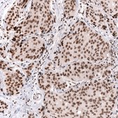 Monoclonal Anti-Smarcb1 Antibody Produced In Mouse Prestige Antibodies&#174; Powered by Atlas Antibodies, clone CL13973, affinity isolated antibody, buffered aqueous glycerol solution