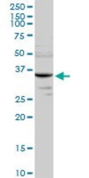 Anti-MMACHC antibody produced in rabbit purified immunoglobulin, buffered aqueous solution