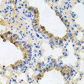 Anti-IGF1R antibody produced in rabbit