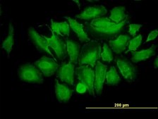 Monoclonal Anti-TRIM25 antibody produced in mouse clone 5C3, purified immunoglobulin, buffered aqueous solution