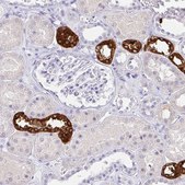 Anti-UMOD antibody produced in rabbit Prestige Antibodies&#174; Powered by Atlas Antibodies, affinity isolated antibody, buffered aqueous glycerol solution
