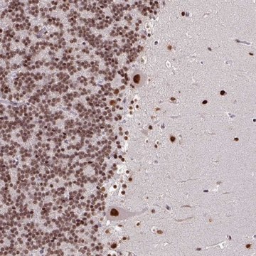 Anti-TDG antibody produced in rabbit Prestige Antibodies&#174; Powered by Atlas Antibodies, affinity isolated antibody, buffered aqueous glycerol solution