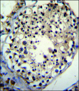 ANTI-ALKBH6 (CENTER) antibody produced in rabbit IgG fraction of antiserum, buffered aqueous solution