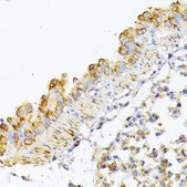 Anti-ATG7 antibody produced in rabbit