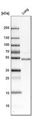 Anti-FOXF1 antibody produced in rabbit Prestige Antibodies&#174; Powered by Atlas Antibodies, affinity isolated antibody, buffered aqueous glycerol solution