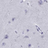 Anti-SERPINA3 antibody produced in rabbit Prestige Antibodies&#174; Powered by Atlas Antibodies, affinity isolated antibody, buffered aqueous glycerol solution