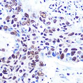 Anti- RBBP4 antibody produced in rabbit
