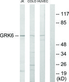 Anti-GRK6 antibody produced in rabbit affinity isolated antibody