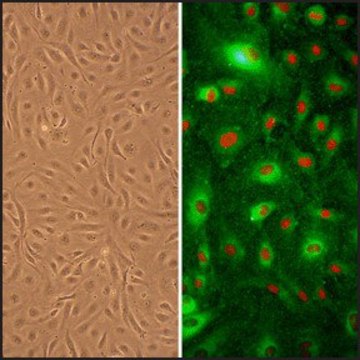 Human Umbilical Artery Endothelial Cells: HUAEC, neonatal