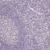 Anti-SLC6A18 antibody produced in rabbit Prestige Antibodies&#174; Powered by Atlas Antibodies, affinity isolated antibody, buffered aqueous glycerol solution