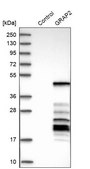 Anti-GRAP2 antibody produced in rabbit Prestige Antibodies&#174; Powered by Atlas Antibodies, affinity isolated antibody, buffered aqueous glycerol solution